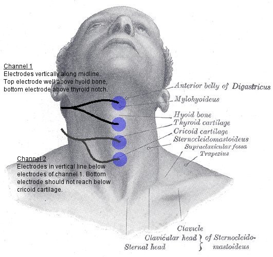 吞咽電極片位置圖