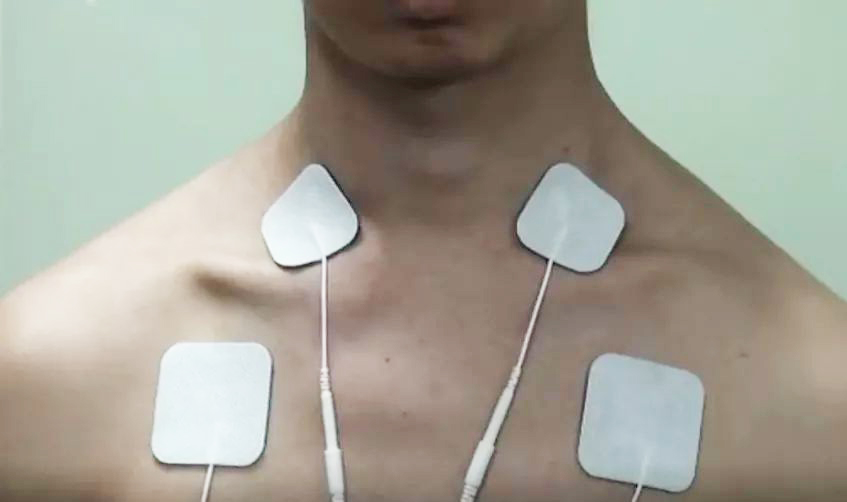 如何選擇合適的無紡布水凝膠理療電極片？